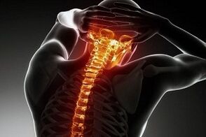 Kesakitan yang berkaitan dengan osteochondrosis
