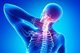Sakit belakang sebagai gejala osteochondrosis