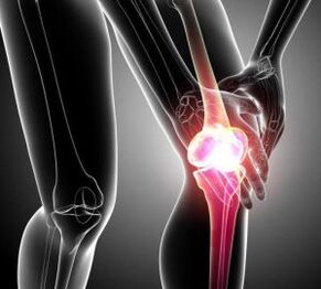 Sakit lutut pada artritis dan osteoartritis