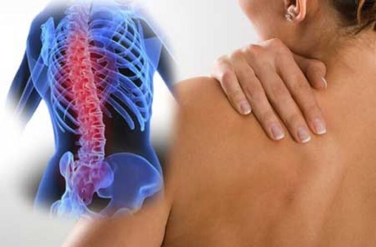 Dengan pemburukan osteochondrosis tulang belakang toraks, sakit dorsago berlaku