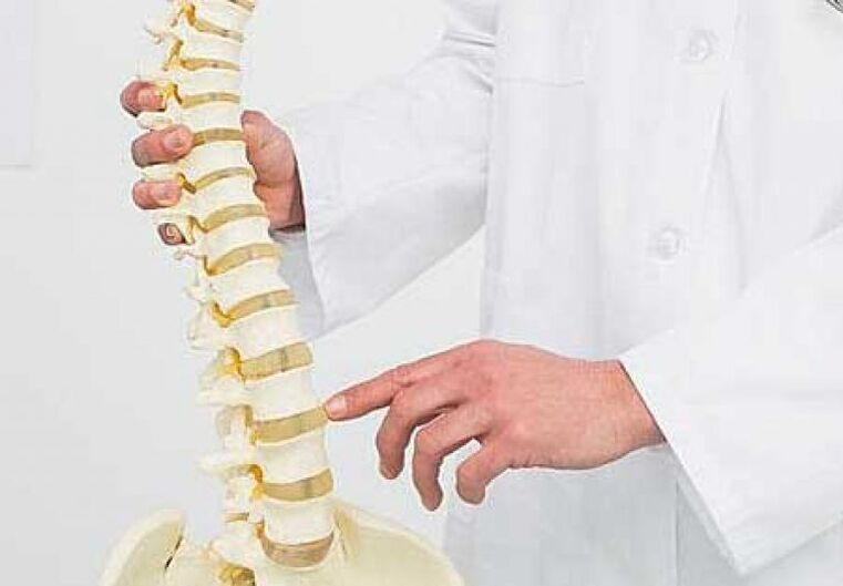Osteochondrosis toraks ditunjukkan oleh pemusnahan cakera intervertebral