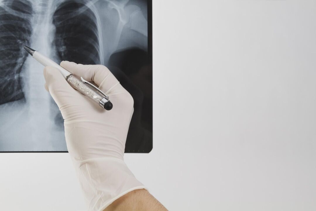 X-ray untuk mendiagnosis osteochondrosis