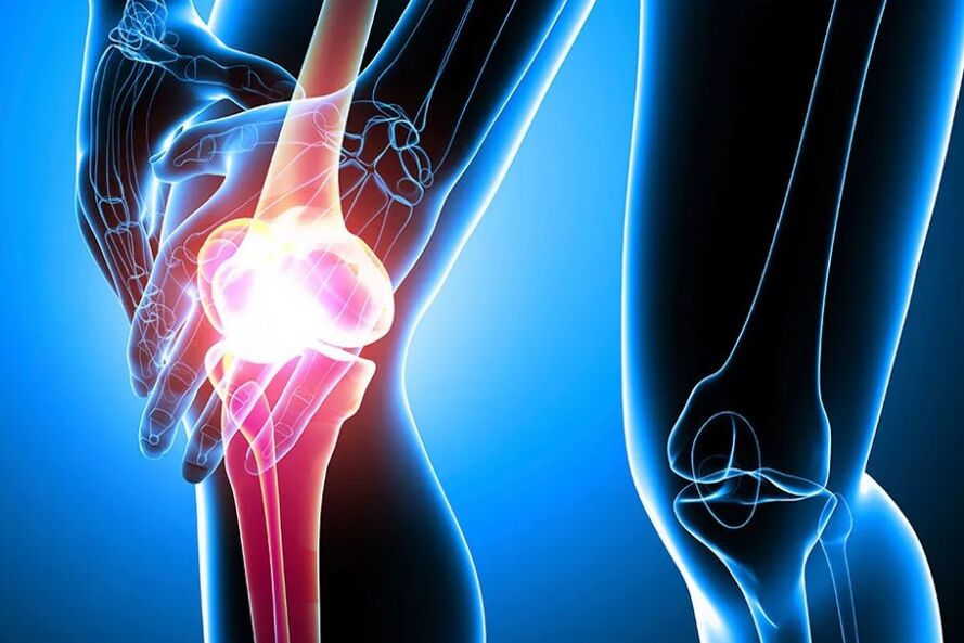 Lutut osteoarthritis