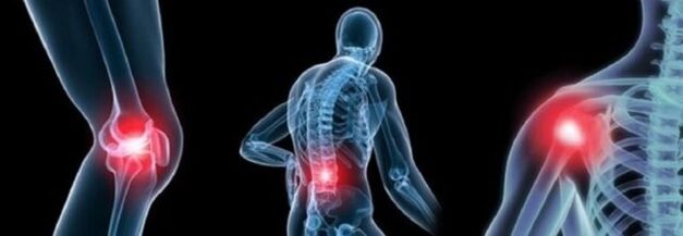 Jenis kesakitan dengan osteoarthritis