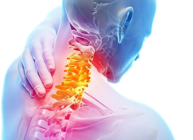 Gejala dan peringkat perkembangan osteochondrosis serviks