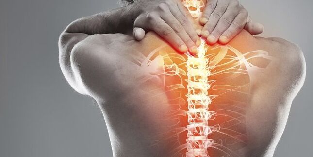 Pilihan perubatan untuk terapi serviks osteochondrosis serviks