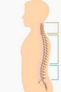 Luka osteochondrosis bahagian -bahagian yang berlainan dari tulang belakang